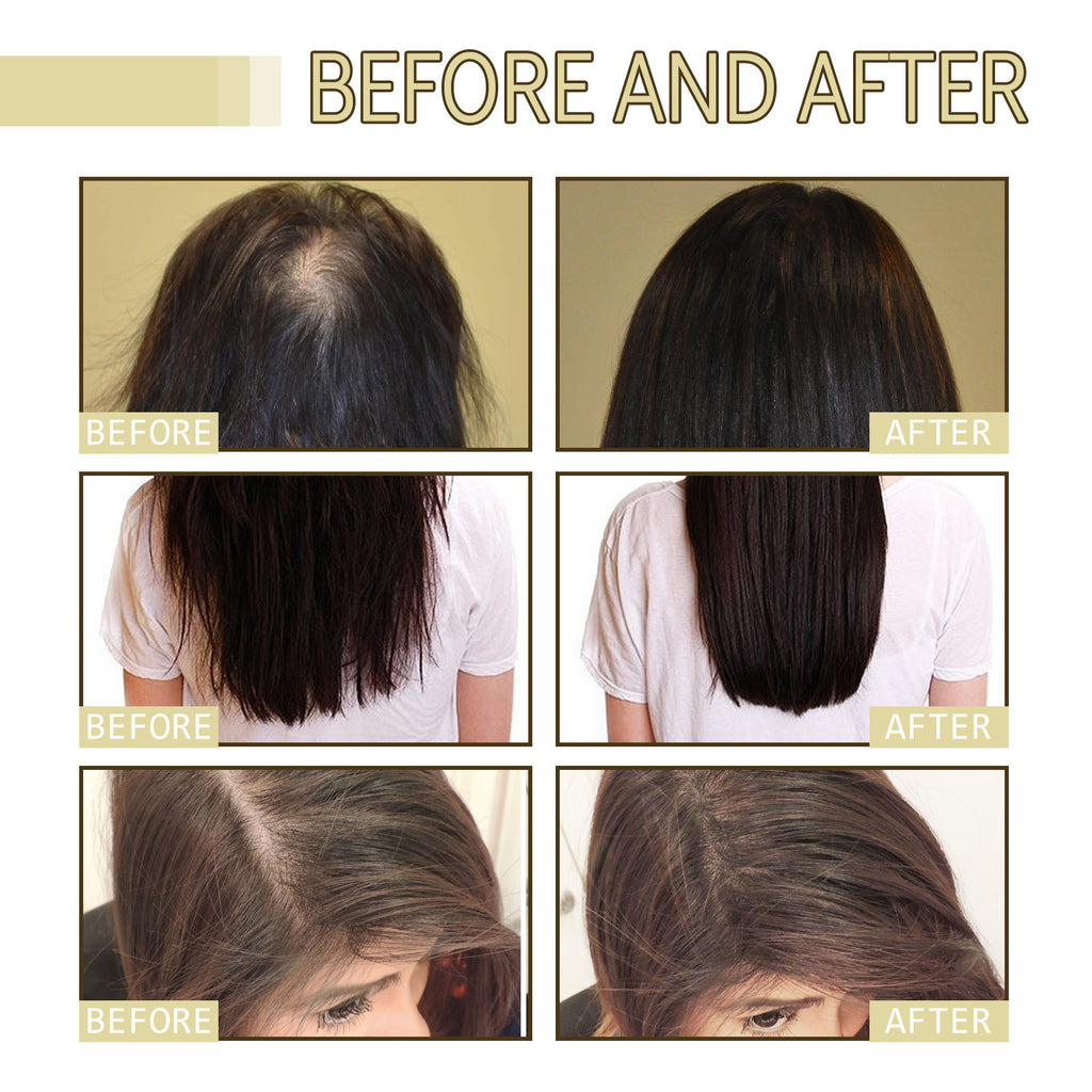 Rosemary Hair Oil for Smooth, Shiny Hair – 60ml